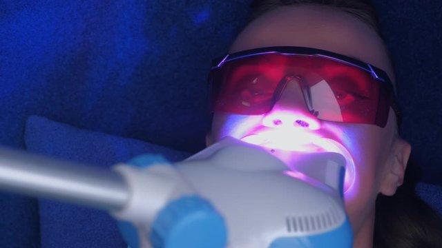 LED whitening beauty cosmetic procedure for woman's teeth in dentistry studio. Portrait of woman with stomatology retractor on teeth. LED, UV lamp, bleaching in protective eyes, face closeup.