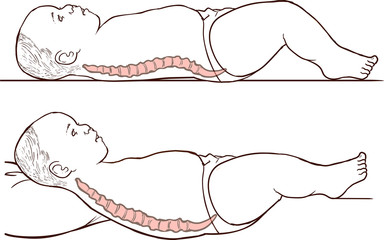  illustration of baby spine and correct lying position