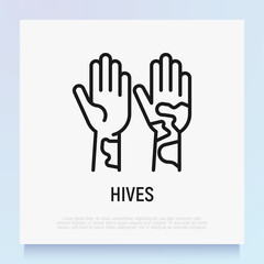 Fototapeta na wymiar Hives on hand thin line icon. Allergy symptom. Modern vector illustration of allergic reaction.