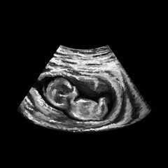 Human embryo on 3rd trimester inside mother’s belly. Balck and white ultrasound illustration