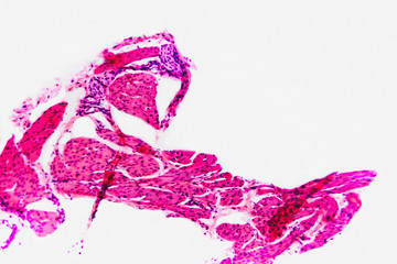 Nature background- cell bladder cat