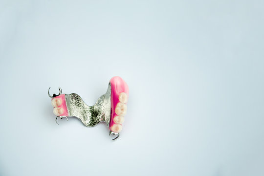 metal denture. arch prosthetics. false teeth. Clammer upper removable denture. concept of dental prosthetics. light background. copy space