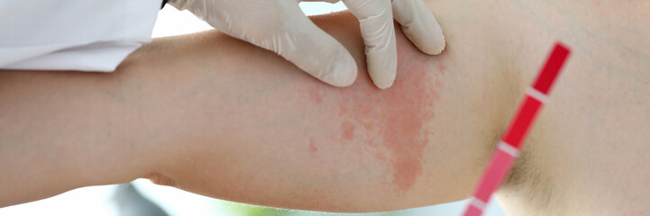 Pharmaceutical drugs express allergy test concept