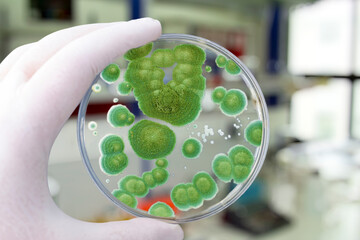 Researcher holding Petri dish with colonies of Penicillium fungi. Penicillium is a mold fungus that...