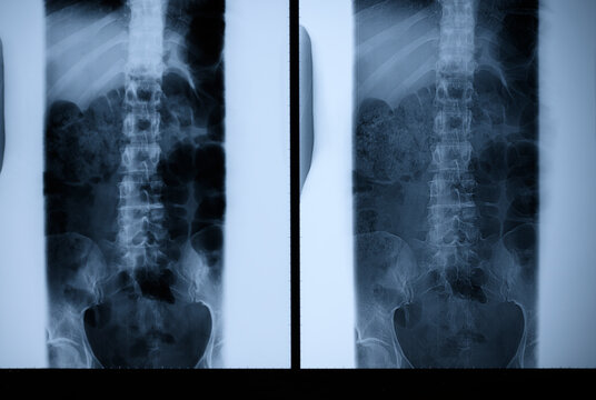 Details of X Ray Frame from Hospital