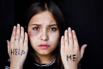Closeup portrait of a young unhappy woman with a bruise. A woman asks for help.