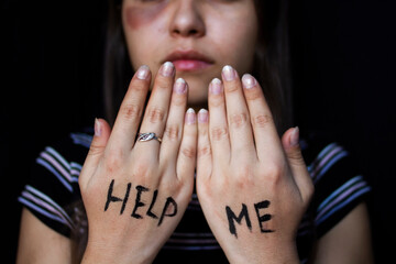 Young woman asks for help