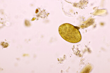 Egg of intestinal fluke in human stool, analyze by microscope, original magnification 400x
