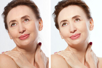 Close up before after Beauty middle age woman face portrait. Spa and anti aging concept Isolated on white background. Plastic surgery and collagen face injections. Wrinkles and menopause. Beauty