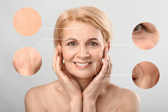 Beautiful mature woman with skin problem on light background. Process of aging