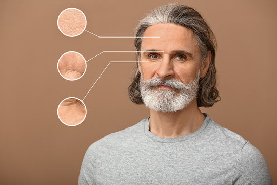 Portrait of mature man with skin problem on color background. Process of aging
