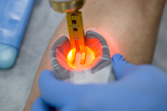 Doctors doing vein surgery procedure