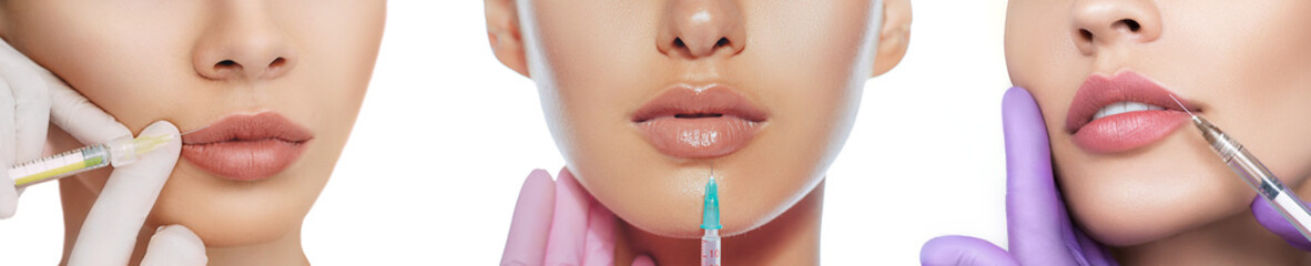 Set of sensual female lips, procedure lip augmentation. Syringe near womans mouth, injections for...