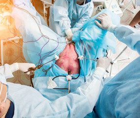 Process of gynecological surgery operation using laparoscopic equipment. Group of surgeons in...