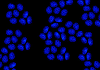 DNA in nuclei of CRISPR edited cells stained with fluorescent blue dye 