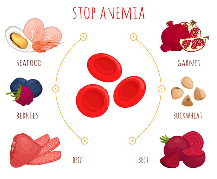 Stop anemia concept. Infographics on the topic of diet with low hemoglobin.  Products that help cure and prevent anemia. Vector illustration on the  theme of health in cartoon style. Stock Vector |