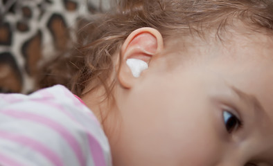 Close up ear of little girl. Ear pain and cotton wool in a ear.