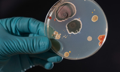 petri dish with microbe colony in doctor hand