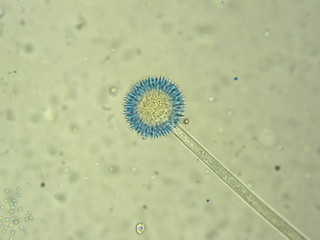 アスペルギルス