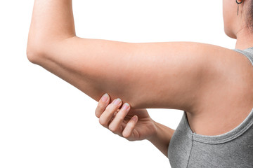 Asian woman pinching arm fat flabby skin isoloate on white background, with clipping path.