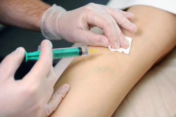 Obraz na płótnie Canvas The doctor injects a syringe under the knee. A doctor makes an injection to the varicose veins on a woman s leg, close-up, sclerotherapy, stripping, phlebeurysm, medical.