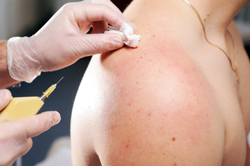 Carbon dioxide therapy (carboxytherapy). Skin rejuvenation.The procedure is performed on the...