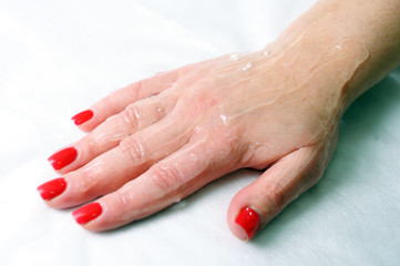 The female hand is covered with a liquid transparent gel before the laser procedure.