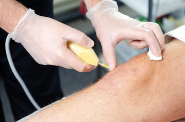 Carbon dioxide therapy (carboxytherapy). Skin rejuvenation.The procedure is performed on the male...