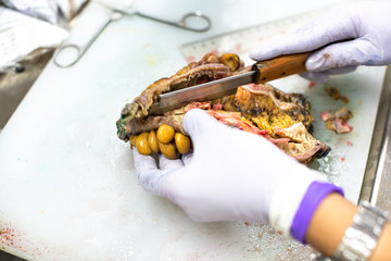 The pathologist is cutting the cancerous tissue from the large intestine for diagnosis.