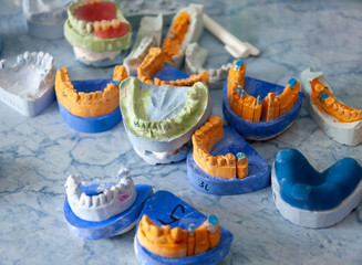 Dentistry molds