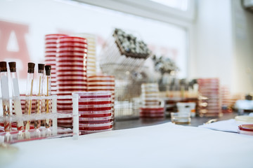 Picture of lab desk with petri dishes, cotton swabs and test tubes.