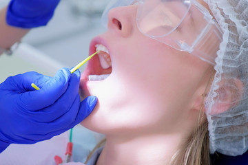 Dentist make fluoridation of teeth after ultrasonic cleaning for young woman. Stomatologist apply fluoride on patient's teeth. Portrait of young woman. Stomatology clinic, cure, treatment, procedure. - obrazy, fototapety, plakaty