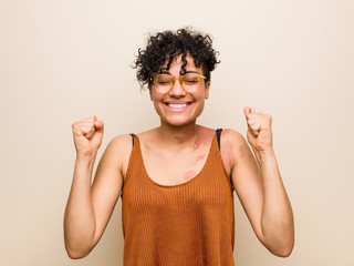Young african american woman with skin birth mark raising fist, feeling happy and successful. Victory concept.