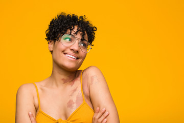 Young african american woman with skin birth mark smiling confident with crossed arms.