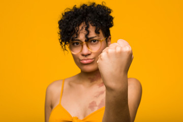 Young african american woman with skin birth mark showing fist to camera, aggressive facial...