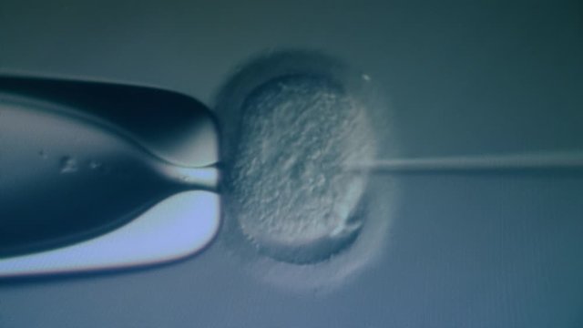 IVF, extracorporal fertilization process. Magnified artificial fertilization of an egg cell