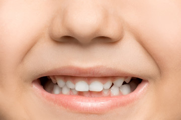 The child smiling shows his baby teeth. Dental concept