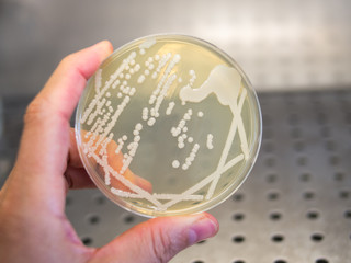 hand holding a petri dish with isolated bacteria colonies in a laminar flow cabinet of a bacteriologial laboratory