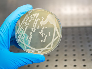 hand holding a petri dish with isolated bacteria colonies in a laminar flow cabinet of a bacteriologial laboratory