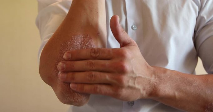 the use of emollient for dry flaky skin, as in the treatment of psoriasis, eczema and other diseases of dry skin
