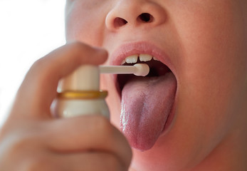 The child sprays his mouth with medicine from a spray can