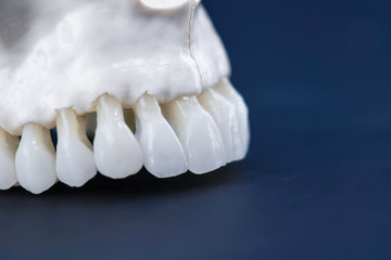 Fototapeta na wymiar Upper human jaw with teeth