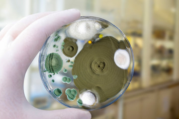 Colonies of different mold fungi grown from indoor air