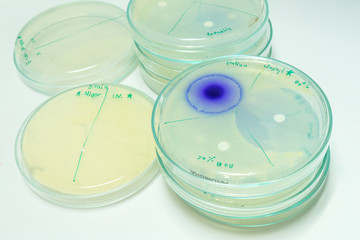 colony of bacteria in petridish