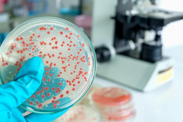 red colony of bacteria in laboratory