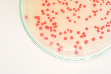 red colony of bacteria in laboratory