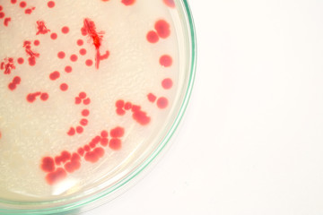red colony of bacteria in laboratory