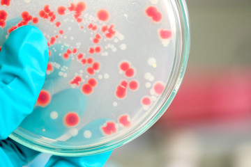 red colony of bacteria in laboratory