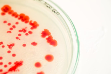 red colony of bacteria in laboratory