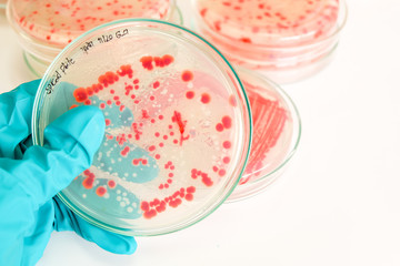 red colony of bacteria in laboratory